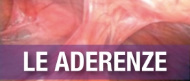 Le “aderenze” o Sindrome Aderenziale