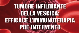 Tumore infiltrante della vescica: efficace l’immunoterapia pre intervento