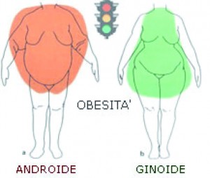 obesità ginoide obesità androide