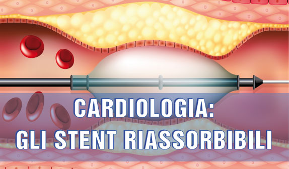 Stent Riassorbibili – Novità in Cardiologia Interventistica