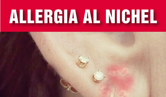 Allergia al Nichel: come affrontarla?