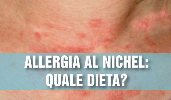 Allergia al Nichel: quale dieta ?