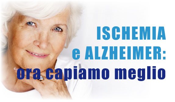 Ischemia e Alzheimer: ora capiamo meglio
