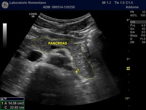 ecografia pancreas ecografia pancreatica