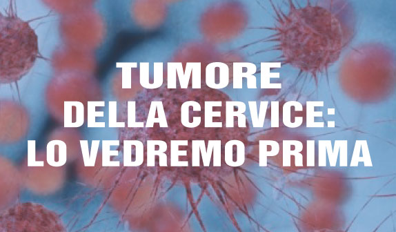tumore cervice cnr