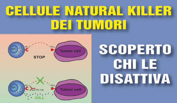 Cellule Natural Killer dei tumori: scoperto chi le disattiva