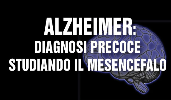 diagnosi alzheimer mesencefalo