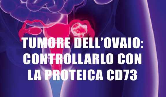Tumore dell’Ovaio: controllarlo con la proteica CD73
