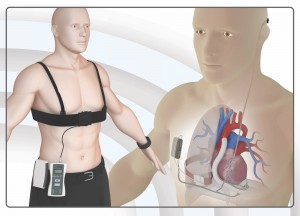 cuore artificiale wireless